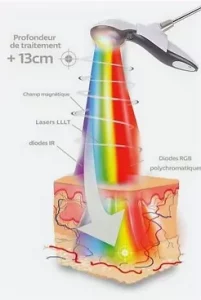 Ici se situe une image