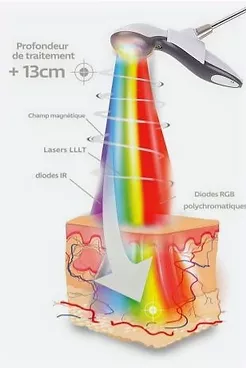 Ici se situe une image